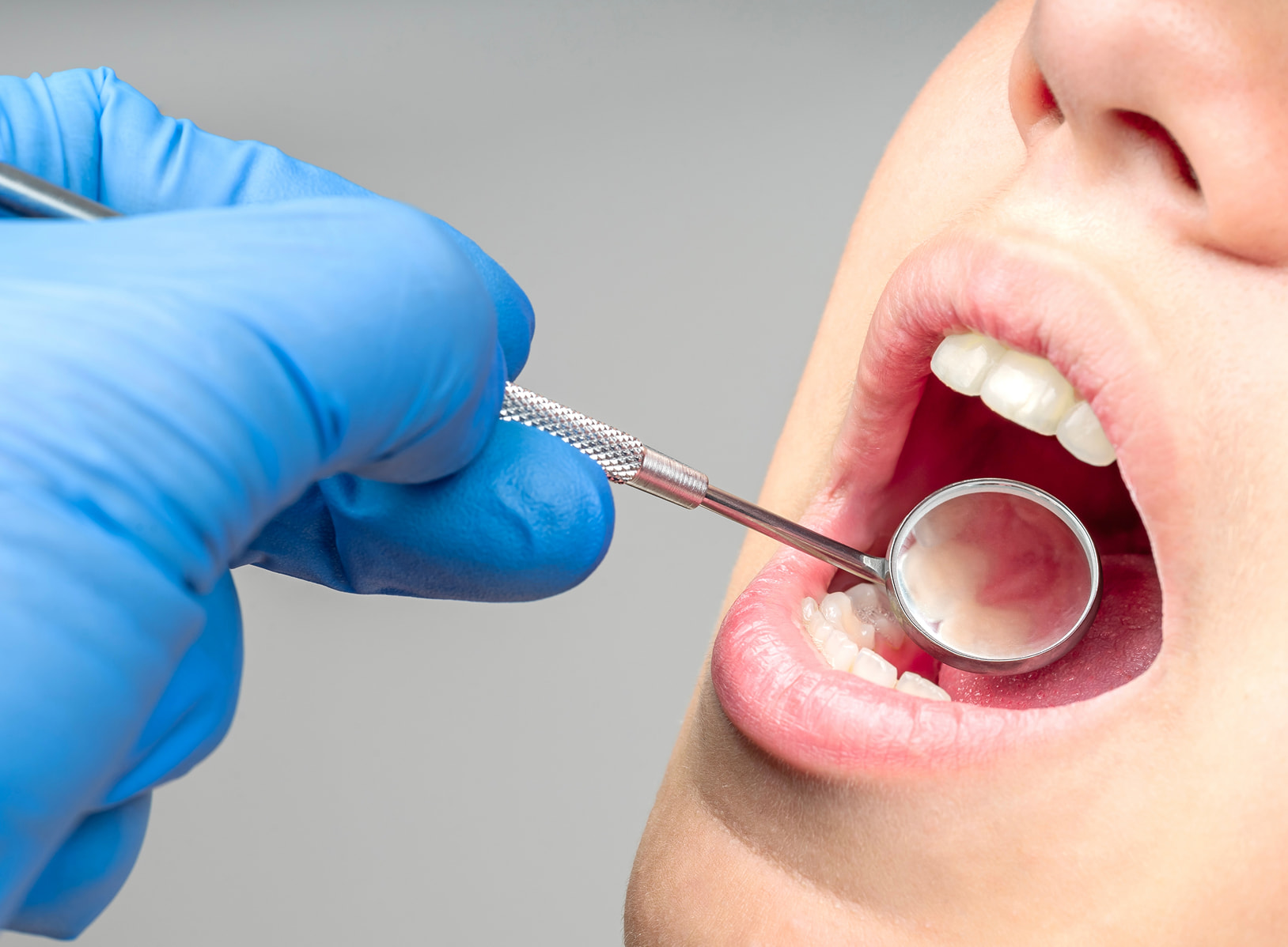 FORMA provides precise and personalized pocket reduction surgery for gum disease